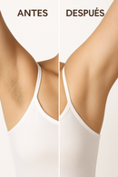 Depiladora IPL profesional para uso doméstico